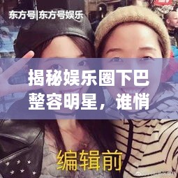 揭秘娛樂圈下巴整容明星，誰悄悄整過下巴？