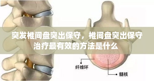 突發(fā)椎間盤(pán)突出保守，椎間盤(pán)突出保守治療最有效的方法是什么 