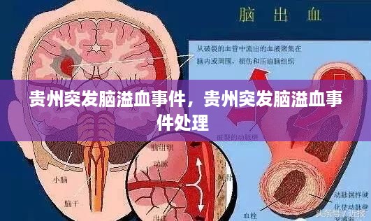 貴州突發(fā)腦溢血事件，貴州突發(fā)腦溢血事件處理 